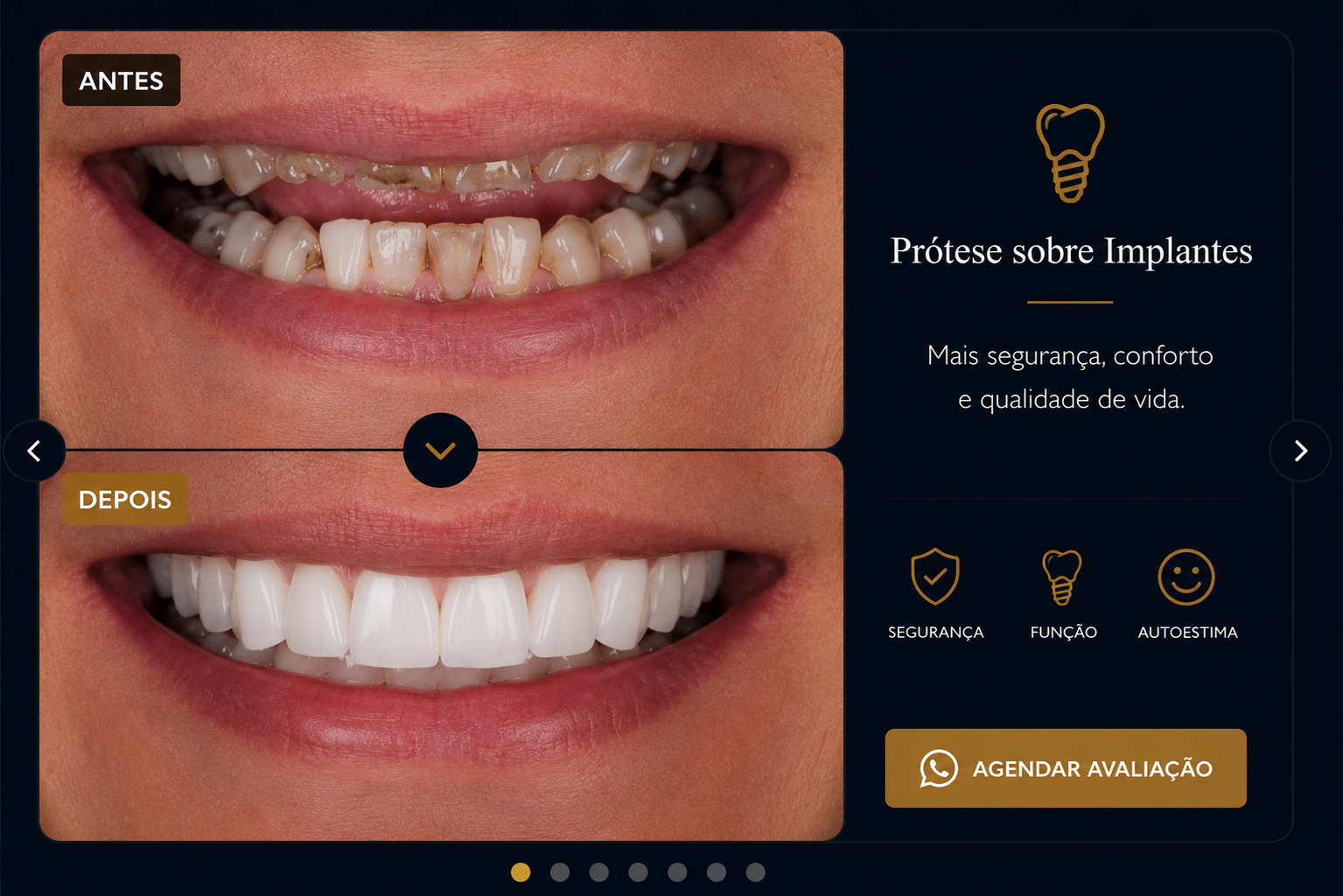 Antes e depois de prótese sobre implantes