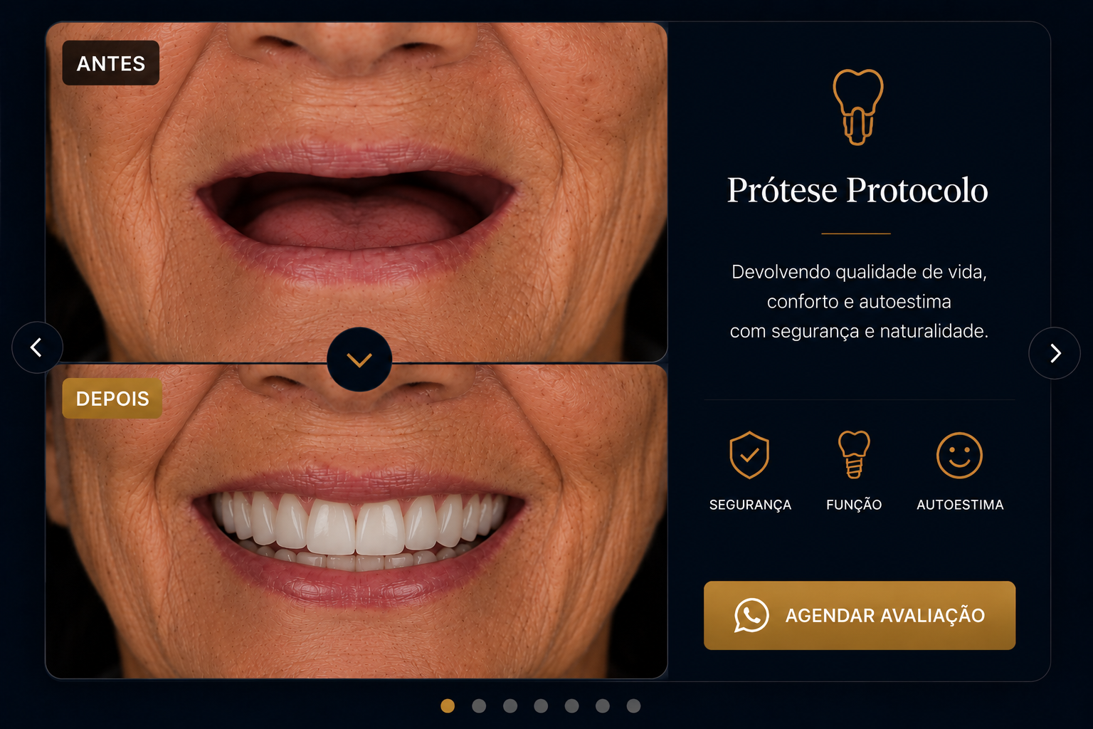 Antes e depois de prótese protocolo